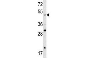 Western blot analysis of SOX4 antibody and A2058 lysate.