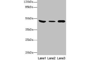 Western Blot All lanes: B4GALT5 antibody at 8 μg/mL Lane 1: Mouse heart tissue Lane 2: Mouse liver tissue Lane 3: Mouse brain tissue Secondary Goat polyclonal to rabbit IgG at 1/10000 dilution Predicted band size: 46 kDa Observed band size: 46 kDa (B4GALT5 antibody  (AA 101-388))