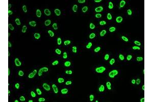 Immunofluorescence (IF) image for anti-Small Nuclear Ribonucleoprotein Polypeptide A (SNRPA) (AA 1-282) antibody (ABIN6148210)
