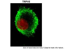 Sample Type: hRetinal pigment epithelial cellsGreen: primaryRed: nuclearPrimary Dilution: 1:200Secondary Antibody: goat anti-rabbit-Alexa 488Secondary Dilution: 1:500Image Submitted by: Brian KennedyIndiana University Northwest . (TRPV5 antibody  (N-Term))