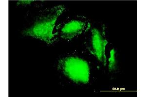 Immunofluorescence of monoclonal antibody to ERN1 on HeLa cell. (ERN1 antibody  (AA 401-500))
