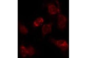 ABIN6276287 staining Hepg2 by IF/ICC. (alpha Fetoprotein antibody  (C-Term))