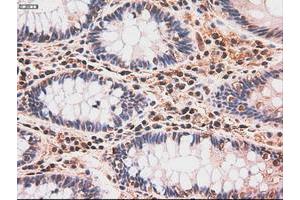 Image no. 5 for anti-Myc Proto-Oncogene protein (MYC) antibody (ABIN1497012) (c-MYC antibody)