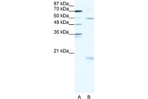 WB Suggested Anti-SOX9 Antibody Titration:  2. (SOX9 antibody  (N-Term))