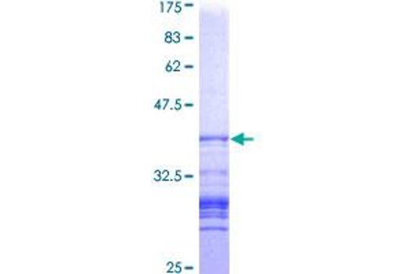 CTNND1 Protein (AA 721-830) (GST tag)