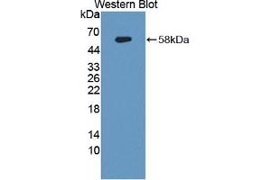 Detection of Recombinant ANXA11, Human using Polyclonal Antibody to Annexin A11 (ANXA11) (Annexin A11 antibody  (AA 1-505))