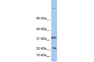Selenoprotein antibody used at 1 ug/ml to detect target protein. (Sep 15 antibody  (Middle Region))