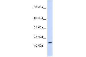 Synuclein Alpha antibody used at 1 ug/ml to detect target protein. (SNCA antibody)