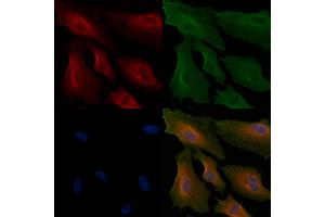 ABIN6264894 and ABIN6266632 staining  cells by IF/ICC.