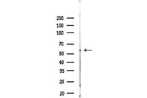 Western blot analysis of lysates from Mouse testis, using Phospho-NF-kB p65 (Ser311) Antibody at 1/1000 dilution.