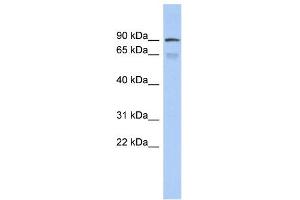 WB Suggested Anti-ZNF791 Antibody Titration:  0. (ZNF791 antibody  (Middle Region))