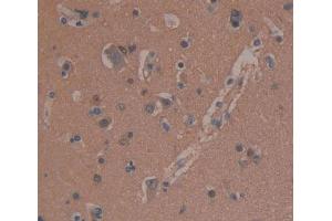 Used in DAB staining on fromalin fixed paraffin- embedded brain tissue (MAP1B antibody  (AA 2207-2468))