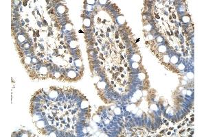 Complement C8b antibody was used for immunohistochemistry at a concentration of 4-8 ug/ml to stain EpitheliaI cells of intestinal villus (arrows) in Human Intestine. (C8B antibody  (Middle Region))