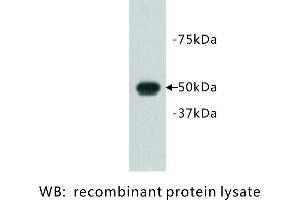 Image no. 1 for anti-FAT Tumor Suppressor Homolog 1 (FAT1) antibody (ABIN1112925) (FAT1 antibody)