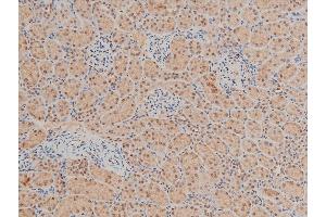 ABIN6267554 at 1/100 staining rat kidney tissue sections by IHC-P.