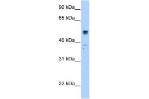 WB Suggested Anti-SLC35F5 Antibody Titration:  2. (SLC35F5 antibody  (C-Term))