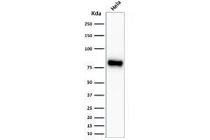 ABIN6383863 to CTNNB1 was successfully used to stain an approx. (Recombinant CTNNB1 antibody)