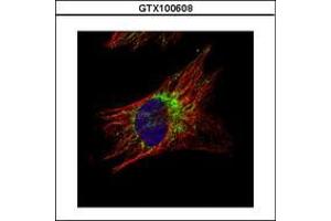 Image no. 3 for anti-DnaJ (Hsp40) Homolog, Subfamily A, Member 3 (DNAJA3) (AA 1-446) antibody (ABIN1497866) (DNAJA3 antibody  (AA 1-446))