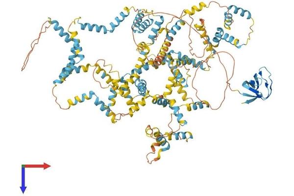 Nebulette Protein (NEBL) (AA 1-1014) (His tag)