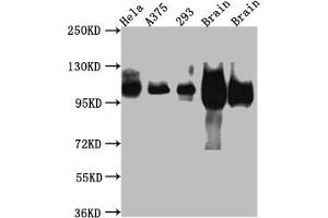 Western Blot Positive WB detected in: Hela whole cell lysate, A375 whole cell lysate, HEK293 whole cell lysate, Rat Brain whole cell lysate, Mouse Brain whole cell lysate All lanes: Amyloid beta A4 antibody at 1:1000 Secondary Goat polyclonal to rabbit IgG at 1/50000 dilution Predicted band size: 87, 35, 77, 79, 79, 81, 83, 85, 86, 73, 85 kDa Observed band size: 100 kDa (Recombinant APP antibody)