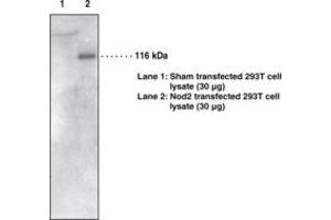 Image no. 1 for anti-Nucleotide-Binding Oligomerization Domain Containing 2 (NOD2) antibody (ABIN1103289) (NOD2 antibody)