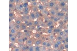 Figure. (GSTM2 antibody  (AA 1-218))