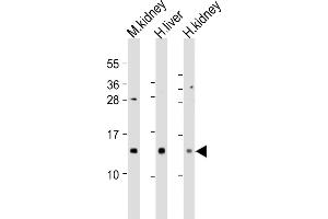 All lanes : Anti-MTCP1 Antibody (C-Term) at 1:2000 dilution Lane 1: mouse kidney lysates Lane 2: human liver lysates Lane 3: human kidney lysates Lysates/proteins at 20 μg per lane. (MTCP1 antibody  (AA 73-103))