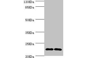 Western blot All lanes: CMPK1 antibody at 3. (Cytidine Monophosphate (UMP-CMP) Kinase 1, Cytosolic (CMPK1) (AA 37-196) antibody)