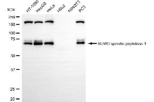 Western blotting analysis using SUMO specific peptidase 1 antibody (ABIN7800975).
