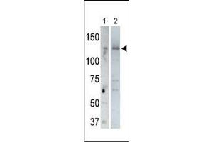 The anti-USP25 C-term Pab (ABIN388918 and ABIN2839197) is used in Western blot to detect USP25 in rat testis tissue lysate (lane 1) and USP25-transfected HeLa cell lysates (lane 2). (USP25 antibody  (C-Term))