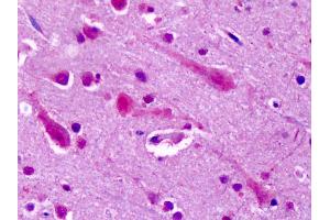 Anti-GRM7 / MGLUR7 antibody IHC of human brain, cortex. (GRM7 antibody  (N-Term))