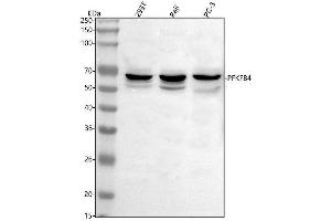Western blot analysis of PFKFB4 using anti-PFKFB4 antibody (ABIN7599238).