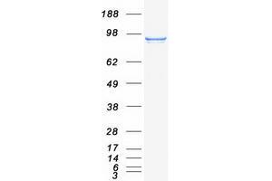 Validation with Western Blot