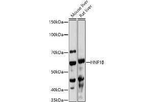 Western blot analysis of extracts of various cell lines, using HNF1B antibody (ABIN3017358, ABIN3017359, ABIN3017360, ABIN1680315 and ABIN1680316) at 1:1000 dilution. (HNF1B antibody  (AA 100-200))