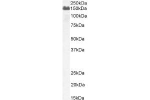 Western Blotting (WB) image for anti-Complement Factor H (CFH) (Internal Region) antibody (ABIN185437)