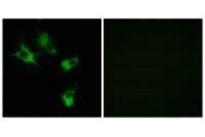 Immunofluorescence analysis of COS-7 cells, using MAST4 antibody.