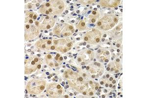 Immunohistochemistry of paraffin-embedded mouse kidney using ID3 antibody (ABIN5973111) at dilution of 1/200 (40x lens). (ID3 antibody)