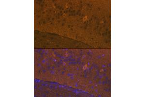 Immunofluorescence analysis of mouse brain cells using GluR1/GRI Rabbit pAb (826) at dilution of 1:100 (40x lens). (Glutamate Receptor 1 antibody  (AA 19-300))