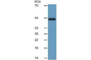 Western Blotting (WB) image for Glutamic-Oxaloacetic Transaminase 1, Soluble (Aspartate Aminotransferase 1) (GOT1) ELISA Kit (ABIN6574261)