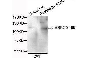 Western blot analysis of extracts of 293 cells, using Phospho-ERK3-S189 antibody. (MAPK6 antibody  (pSer189))