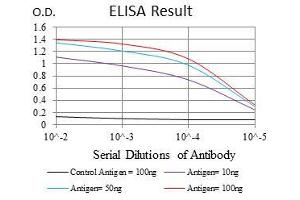 Black line: Control Antigen (100 ng), Purple line: Antigen(10 ng), Blue line: Antigen (50 ng), Red line: Antigen (100 ng), (Ubiquitin B antibody)