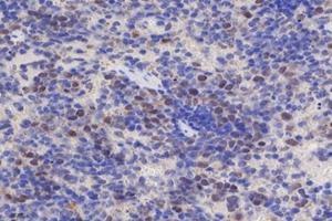 Immunohistochemistry analysis of paraffin-embedded mouse spleen using,EDD (ABIN7076102) at dilution of 1: 700 (UBR5 antibody)
