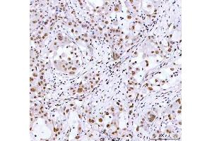 IHC analysis of ARID1A using anti-ARID1A antibody (ABIN7602567). (ARID1A antibody  (AA 857-1552))