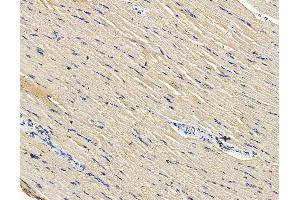 ABIN7096452 and ABIN7100516 at 1/100 staining rat muscle tissue by IHC-P.