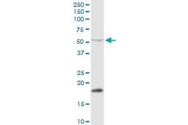 PPM1J antibody  (AA 1-505)