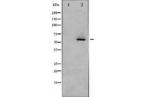Western blot analysis of Akt2 expression in TNF-α treated A2780 whole cell lysates,The lane on the left is treated with the antigen-specific peptide. (AKT2 antibody  (C-Term))