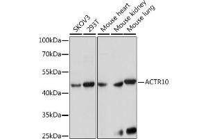 Western blot analysis of extracts of various cell lines, using  antibody (ABIN7265390) at 1:1000 dilution. (ACTR10 antibody  (AA 218-417))