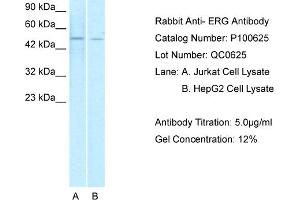WB Suggested Anti-ERG  Antibody Titration: 1. (ERG antibody  (Middle Region))