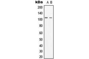 Western blot analysis of GCP3 expression in HEK293 (A), K562 (B) whole cell lysates. (FOLH1B antibody  (Center))