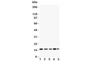 Western blot testing of TIA-1 antibody and Lane 1:  Jurkat (TIA1 antibody  (N-Term))